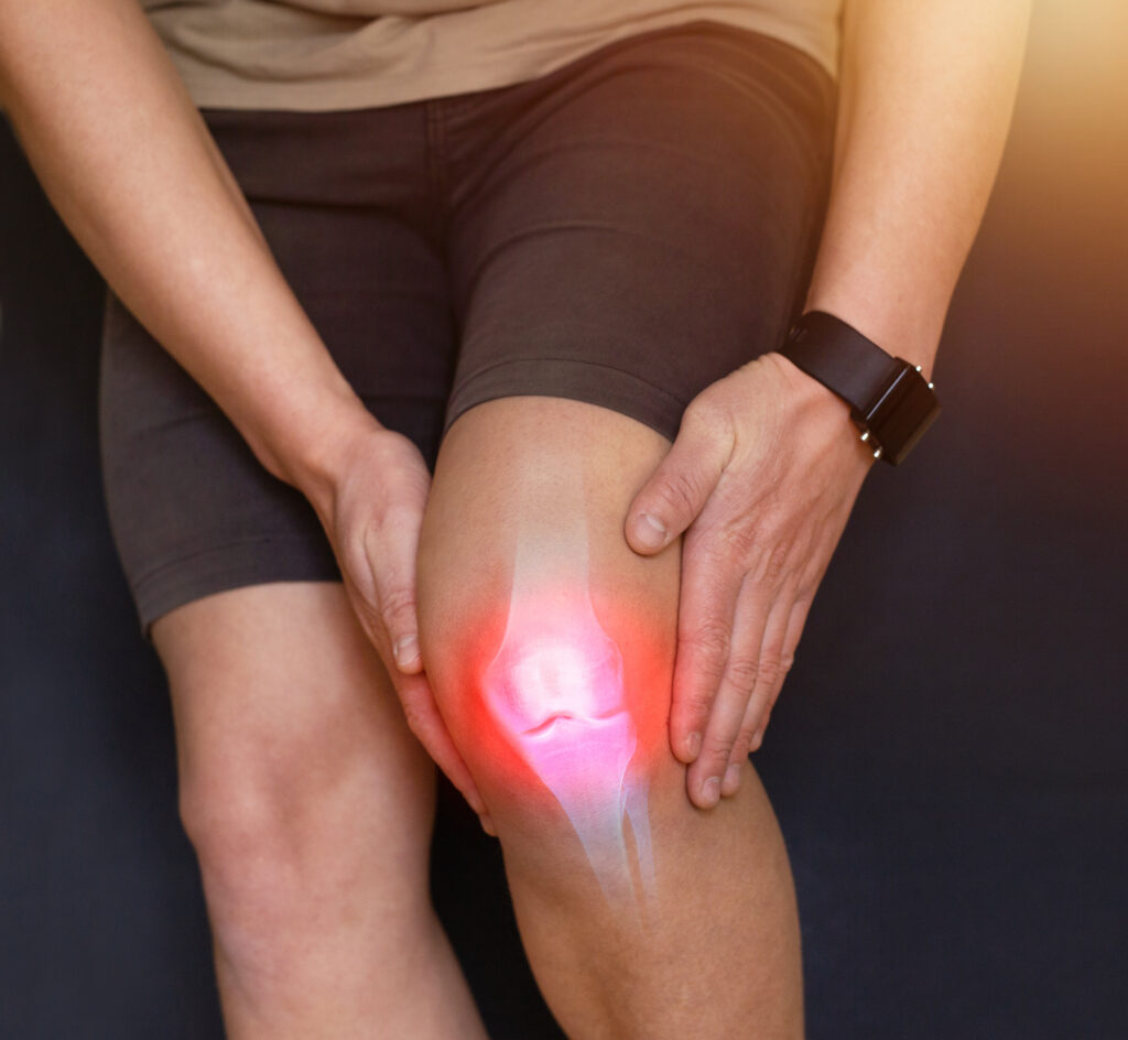 exercises prior to total knee replacement